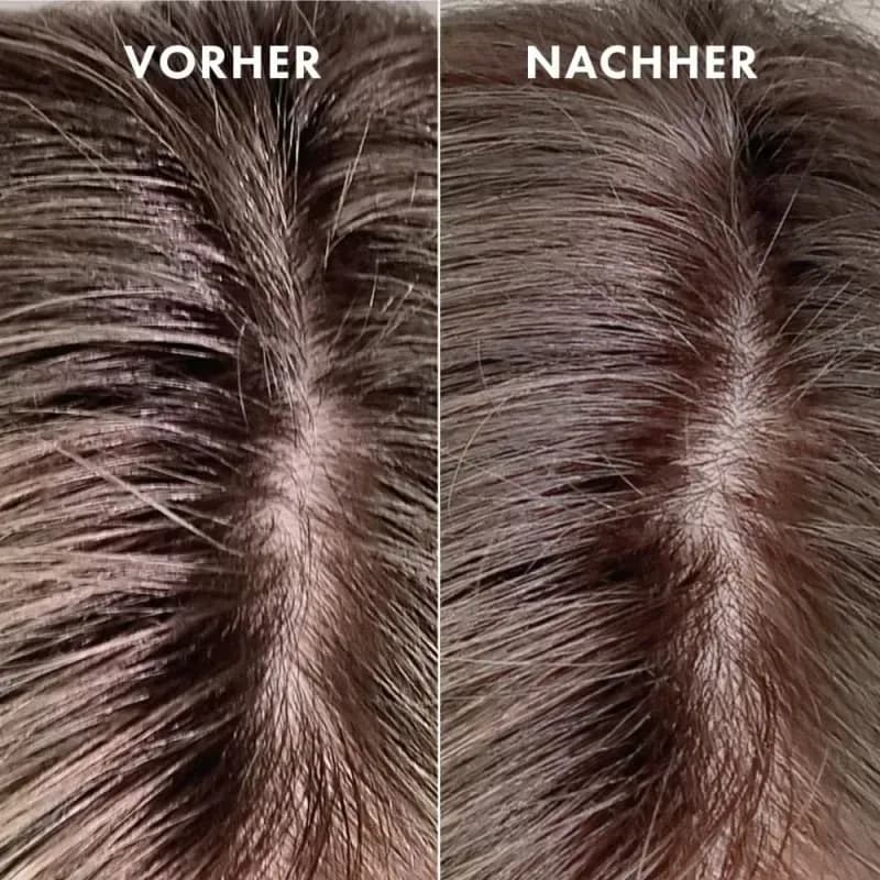 Trockenschaum Shampoo ohne Wasser – Schnelle Haarauffrischung mit Frische-Effekt für unterwegs
